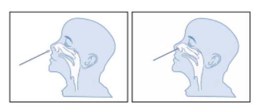 covid-19 test