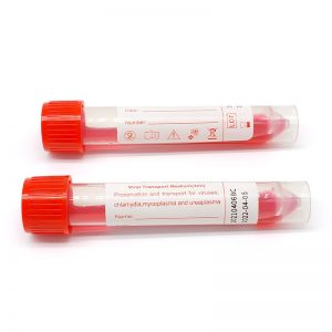 3 Reasons to Use Viral Transport Medium Tube, Uses & Advantages 3 Reasons to Use Viral Transport Medium Tube, Uses & Advantages