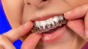 Is there any harm in dental scaling? The role of teeth cleaning