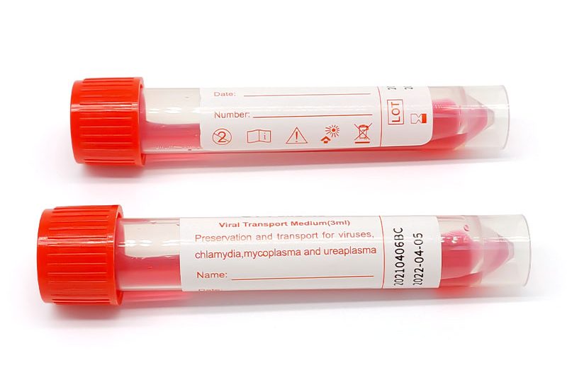 COVID-19 Ag Rapid Test KitViral Transport Medium