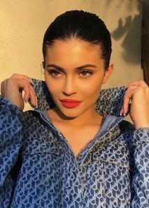 Lip Fillers Before and After, Lip Fillers vs Fat Grafting