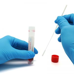 Was ist ein Virus-Probenahme-Kit? Was ist ein Virus-Probenahme-Kit?