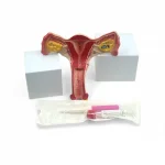 Cervi-Collect Specimen Collection Kit