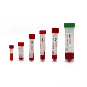 IVD in vitro diagnostic reagents summary IVD in vitro diagnostic reagents summary