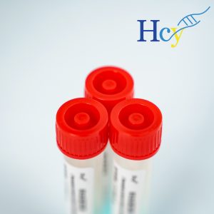 What If We Had No Sample Transport Media? A Thought Experiment